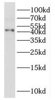 IGSF11 Antibody