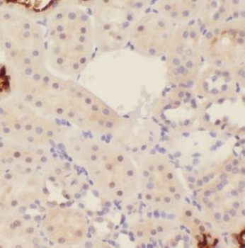 IGSF11 Antibody