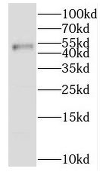 IKZF1 Rabbit Polyclonal Antibody