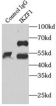 IKZF1 Rabbit Polyclonal Antibody