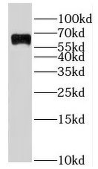 IKZF3 Rabbit Polyclonal Antibody