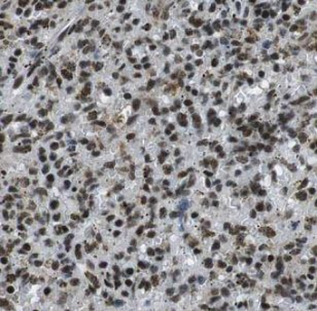 IKZF3 Rabbit Polyclonal Antibody
