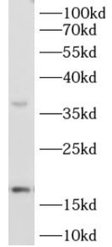 IL1B Rabbit Polyclonal Antibody