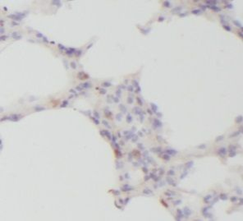 IL1B Rabbit Polyclonal Antibody