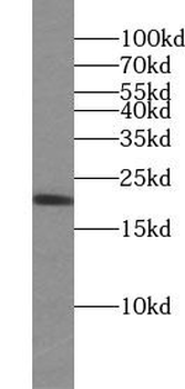 IL10 Rabbit Polyclonal Antibody