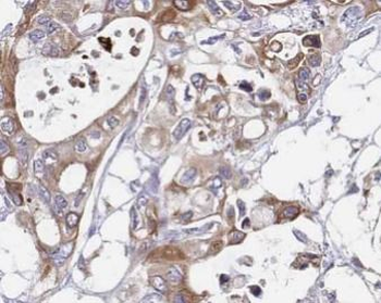 IL10 Rabbit Polyclonal Antibody