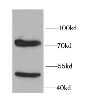 IL10RA Antibody