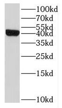 IL10RB Antibody