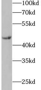 IL11RA Antibody