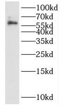 IL15RA Antibody