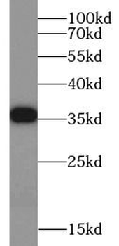 IL20RB Mouse Monoclonal Antibody