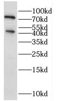 IL5RA Antibody