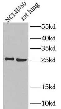 IL6 Antibody