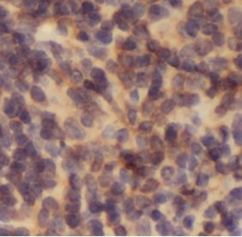 IL6R Antibody