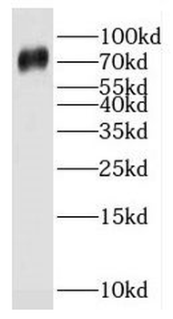 SPPL2C Rabbit Polyclonal Antibody
