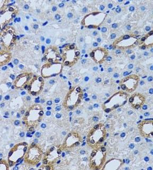 IMPA1 Rabbit Polyclonal Antibody