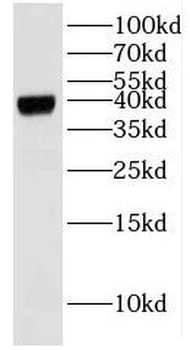 BPNT2 Antibody