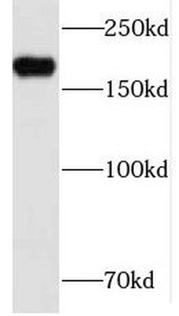 INF2 Rabbit Polyclonal Antibody