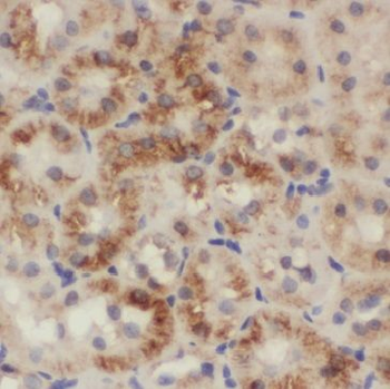 INF2 Rabbit Polyclonal Antibody