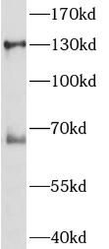 NOS2 Rabbit Polyclonal Antibody