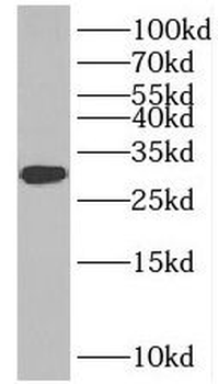INSIG2 Rabbit Polyclonal Antibody