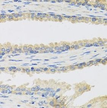 INSL3 Rabbit Polyclonal Antibody