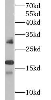 IFNA1 Rabbit Polyclonal Antibody