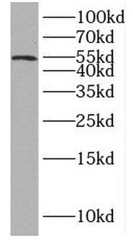 IP6K1 Rabbit Polyclonal Antibody