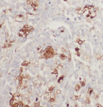 IP6K1 Rabbit Polyclonal Antibody