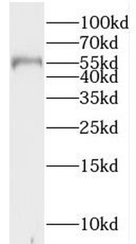IPPK Rabbit Polyclonal Antibody