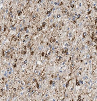 IPPK Rabbit Polyclonal Antibody