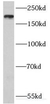 IQGAP1 Rabbit Polyclonal Antibody