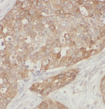 IQGAP1 Rabbit Polyclonal Antibody