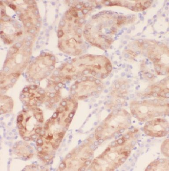 IQSEC2 Rabbit Polyclonal Antibody