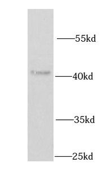 IRF2 Rabbit Polyclonal Antibody