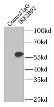 IRF2BP2 Rabbit Polyclonal Antibody