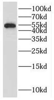 IRF4 Antibody