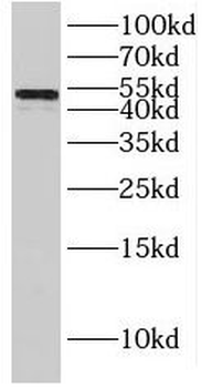 IRF8 Rabbit Polyclonal Antibody