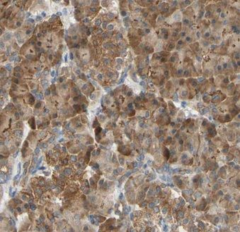 ISYNA1 Rabbit Polyclonal Antibody