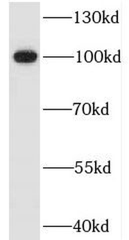 ITIH3 Rabbit Polyclonal Antibody