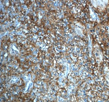 ITIH3 Rabbit Polyclonal Antibody