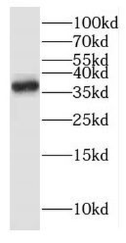 ITLN1 Rabbit Polyclonal Antibody