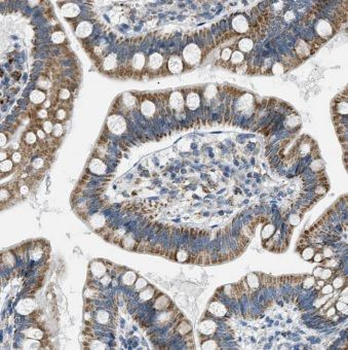 ITLN1 Rabbit Polyclonal Antibody