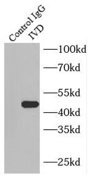 IVD Rabbit Polyclonal Antibody