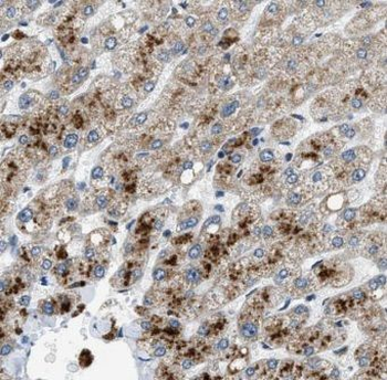IVD Rabbit Polyclonal Antibody