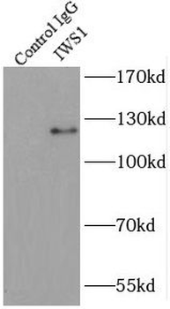 IWS1 Rabbit Polyclonal Antibody