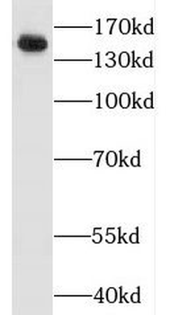 JAG2 Rabbit Polyclonal Antibody