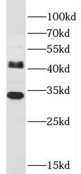 JAM2 Rabbit Polyclonal Antibody