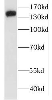 MAPK8IP3 Rabbit Polyclonal Antibody