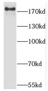 KDM6B Rabbit Polyclonal Antibody